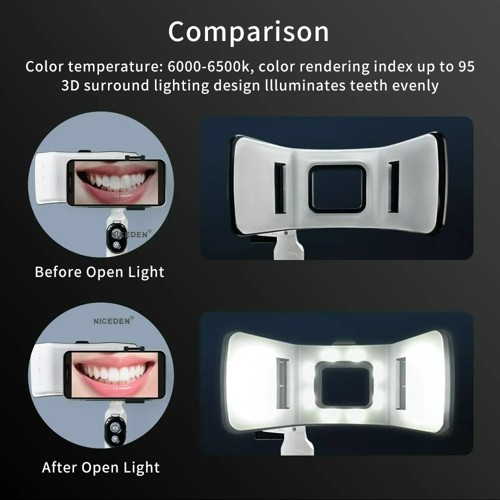 Dental-Fotografie-Licht für Sm – Photography Dental Bewertung und Preis