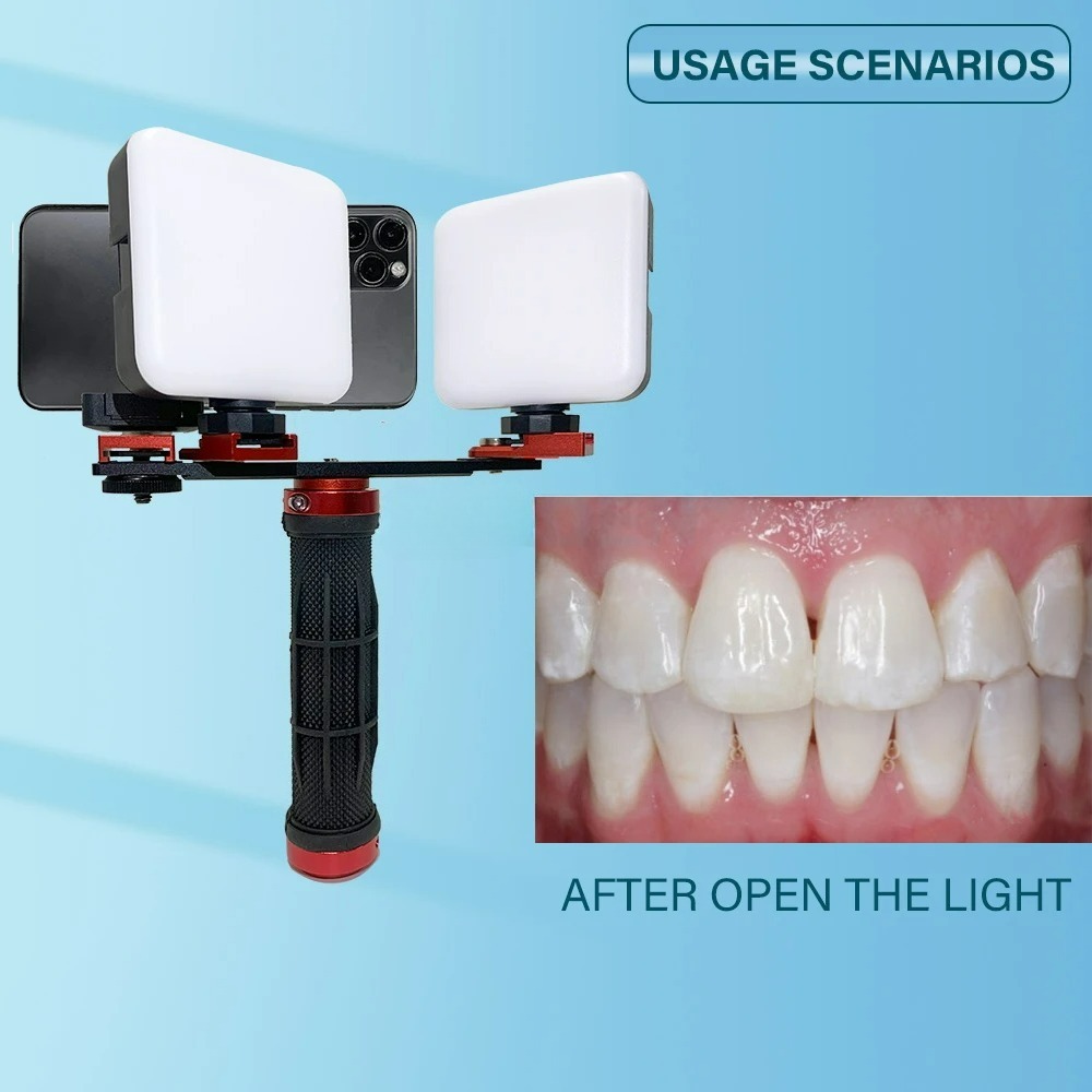 Dental-Fotografie-Licht für Sm – Photography Dental Bewertung und Preis