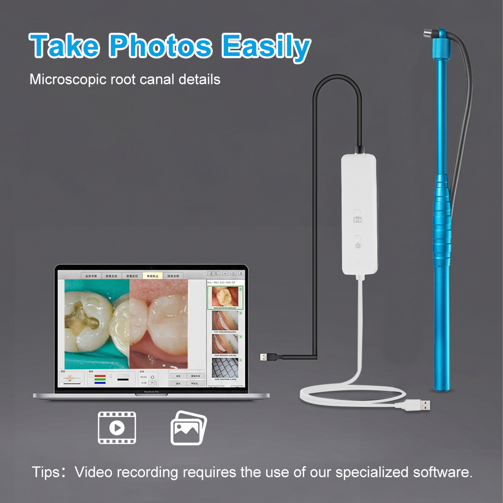 5MP Mikro-Intraoralkamera, Den – Photography Dental Bewertung und Preis